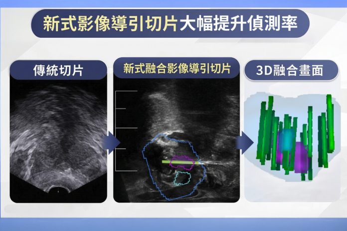 影像導引切片立功　雲林兩老農成功治療攝護腺癌