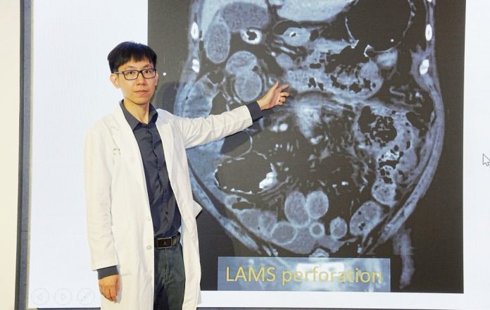 小小膽結石恐引發壞死性胰臟炎 中醫大附醫多專科團隊合力逆轉重症 大幅提升存活率