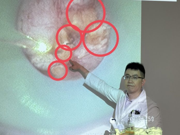 她的腎臟像長滿葡萄乾的雜糧麵包！  原來是「雷氏斑」作祟