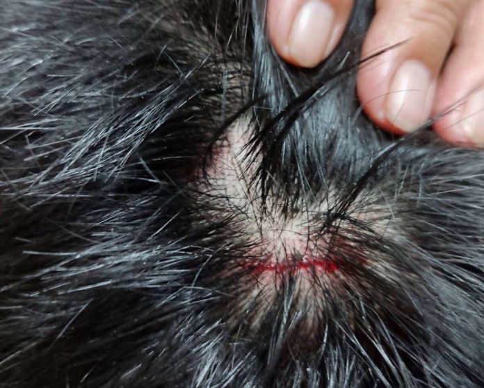 10多隻流浪犬狂追！彰化13歲男童摔車濺血