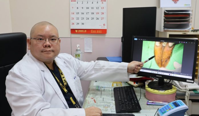 「中標」快去看醫生！30歲男下體長菜花拖2年 竟冒出103顆