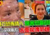 【獨家有影】必比登名店氣爆女子幾近毀容 揭「恐怖情人」楊萬來惡行:家暴令氣爆後才下來