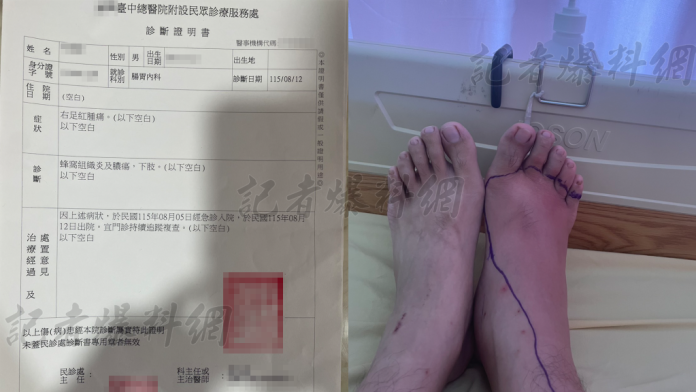 替代役再爆醜聞！役男就醫遭幹部放生　延誤治療釀「蜂窩性組織炎」險截肢
