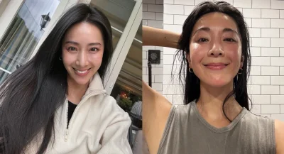 45歲隋棠大方認了做醫美！曬電波術後「真面目素顏照」